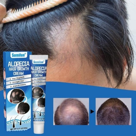 Hair Growth Cream