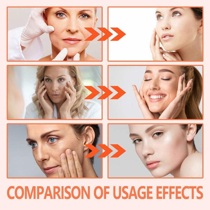 Rose Oil Smoothen Fine Wrinkles Skin Care Brightening And Firming Skin Care