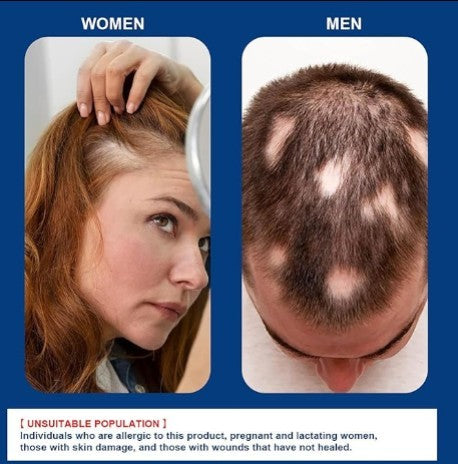 Hair Growth Cream